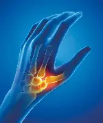 epitact® Flexible Daumenbandage Zusätzliches Produktbild für epitact Flexible Daumenbandage