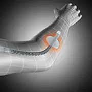 Zusätzliches Produktbild für Sporlastic Ellenbogenbandage Epidyn-Stabil